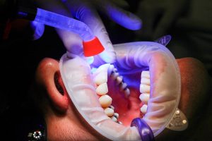 Read more about the article ▷ Sonhar com Dentista 【Tudo o que você precisa saber】